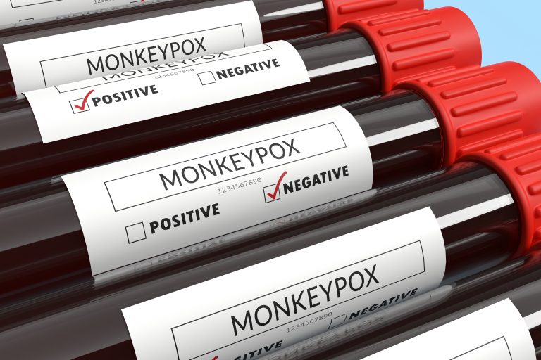 Monkeypox negative result area checked with red highlighter blood test tubes on blue background with copy space.
