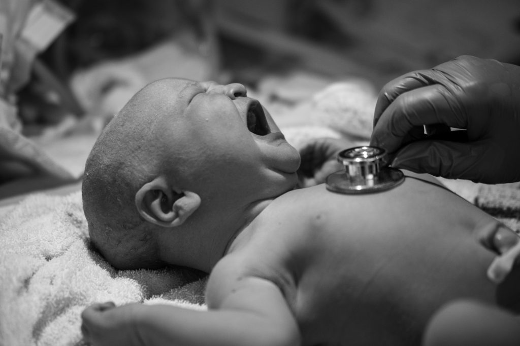 Newborn baby being examined by paediatric doctors moments after