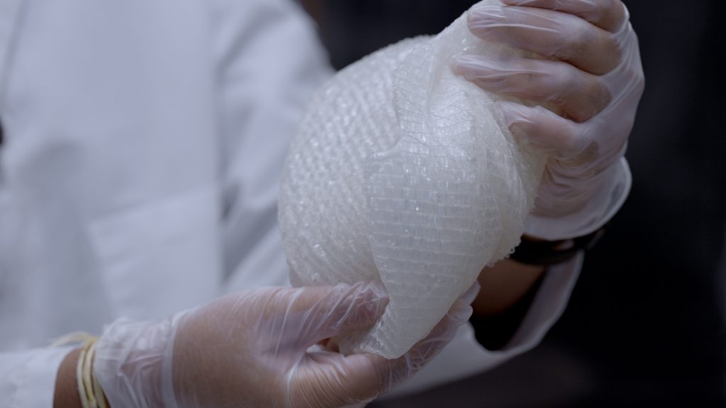 Biomedical engineer Liisa Kuhn holds the soft, breathable material that serves as an alternative to uncomfortable, unnatural-looking prosthetics.