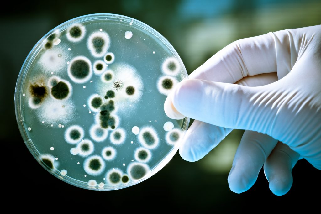 A gloved hand holds a petri dish showing enlarged images of bacteria.