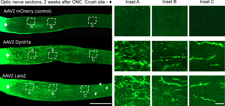 Three sections of optic nerve that were injured by crushing (the white diamond on the far left of each nerve marks the crush point.) The lower two nerves each express genes (Dynlt1a or Lars2) newly identified by the Trakhtenberg lab as promoting nerve axon regeneration. The axons carry the bright green dye. The insets to the right show how much more axon regrowth is occurring in the nerves that express the regeneration genes, and how no regrowth happens in the normal control (top).