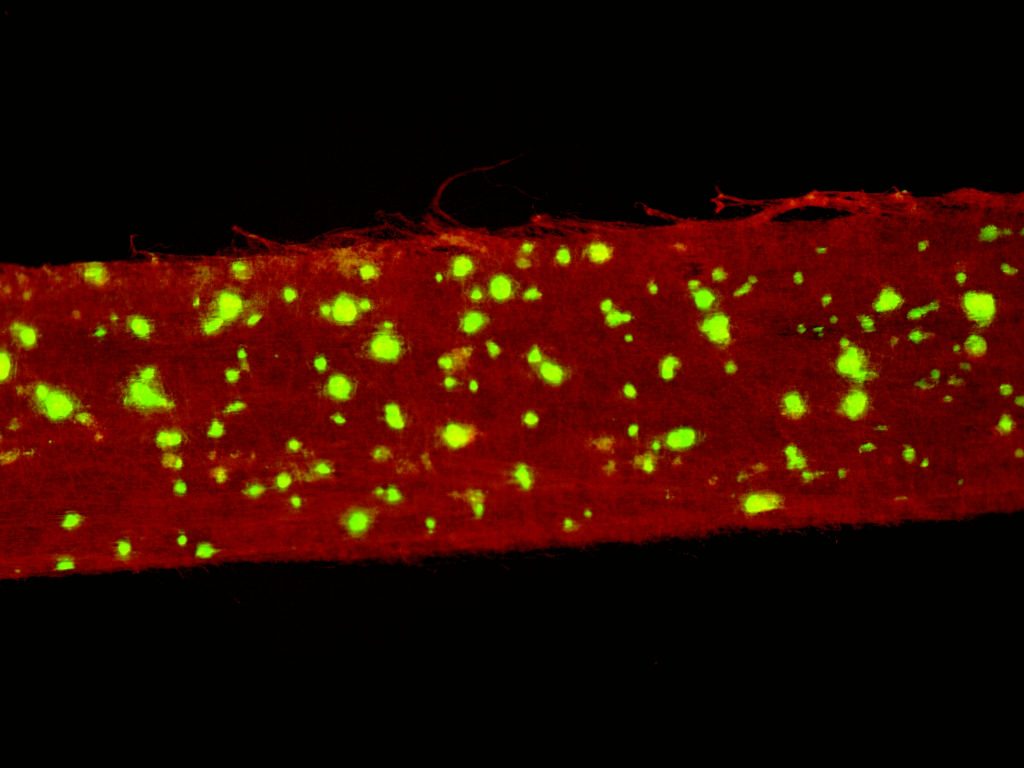Skin cells grown into nanofiber scaffold.