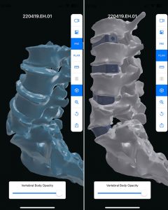 images of spine anatomy