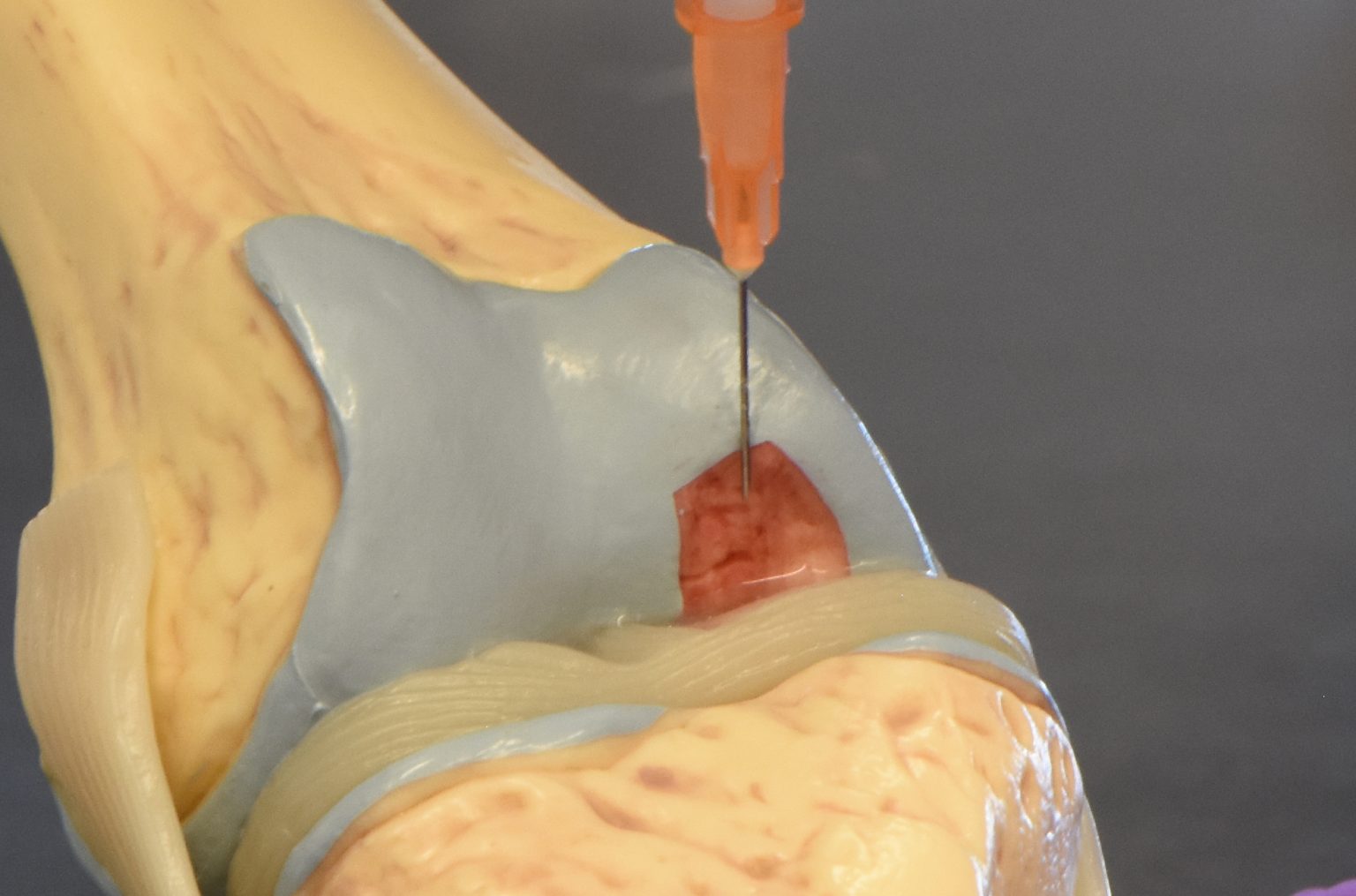 Gel Repairs Cartilage Without Surgery, With Electricity UConn Today — free download