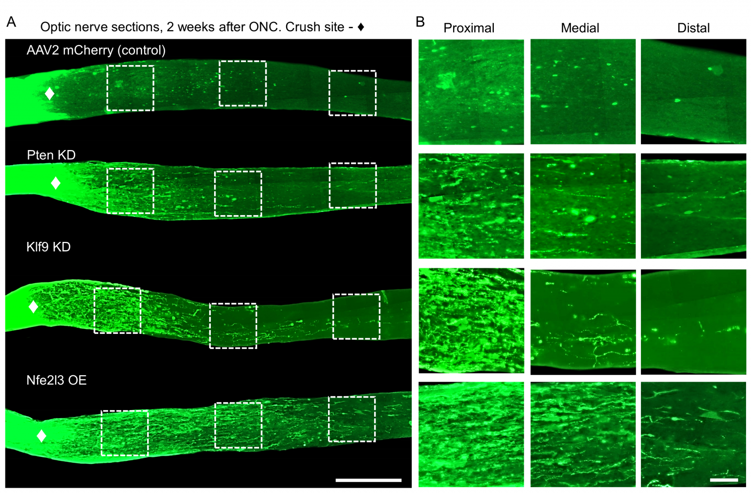 Seeing a Path to Nerve Regeneration - UConn Today