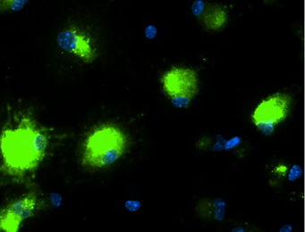 Lab image of inflamed kindney cells.