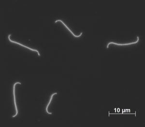Corkscrew-shaped bacteria seen through a microscope.