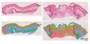 Images showing the distribution of cells in the skin of intact (left) and wounded (right) mice. The colors represent different cell types. The black lines show the edges of the wound.