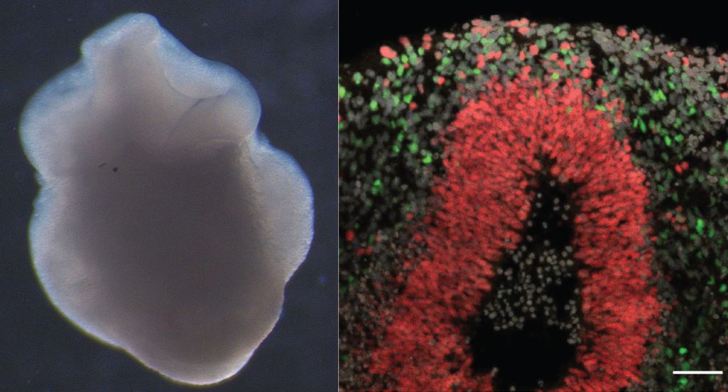 Brain organoids are 3D organized tissue from human induced pluripotent stem cells (iPSCs), that are derived from humans fibroblasts or blood cells. They form nascent layers with neuronal cells (CTIP2 markers colored green) and stem cells (SOX2marker colored red) and they are useful to model neurological diseases including inflammatory diseases and brain tumors. (Images courtesy of Imitola Lab).