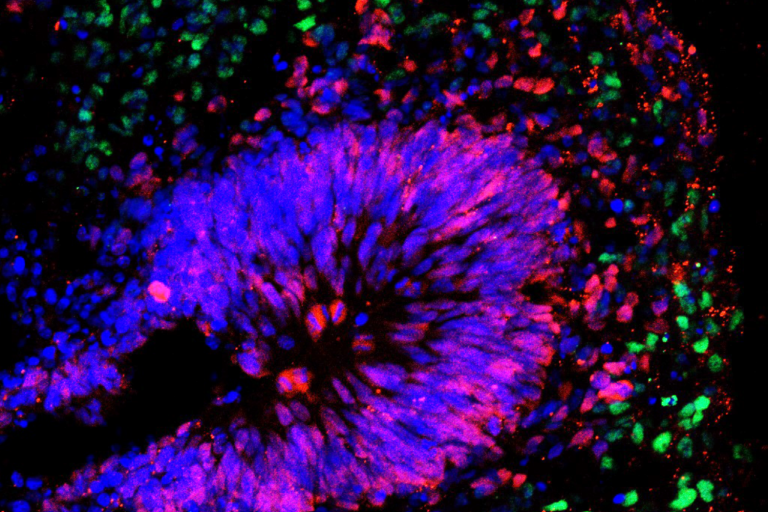 Imitola Lab image shows the inside of a 3D brain organoid formation's layers of stem cells. Blue is nuclear staining, red is SOX2, a stem cell marker, and green is a cortical neuron progenitor marker (CITP2).