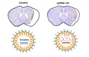 Scientific diagram showing mouse brain atrophy