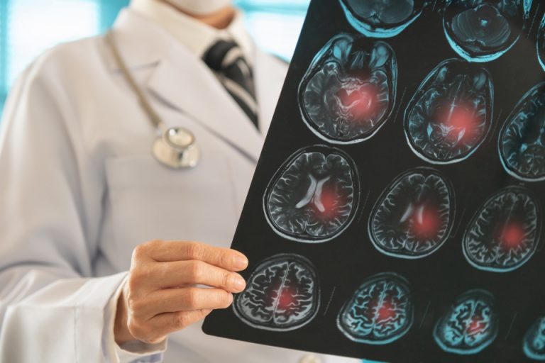 Stock photo of a doctor examining MRI results