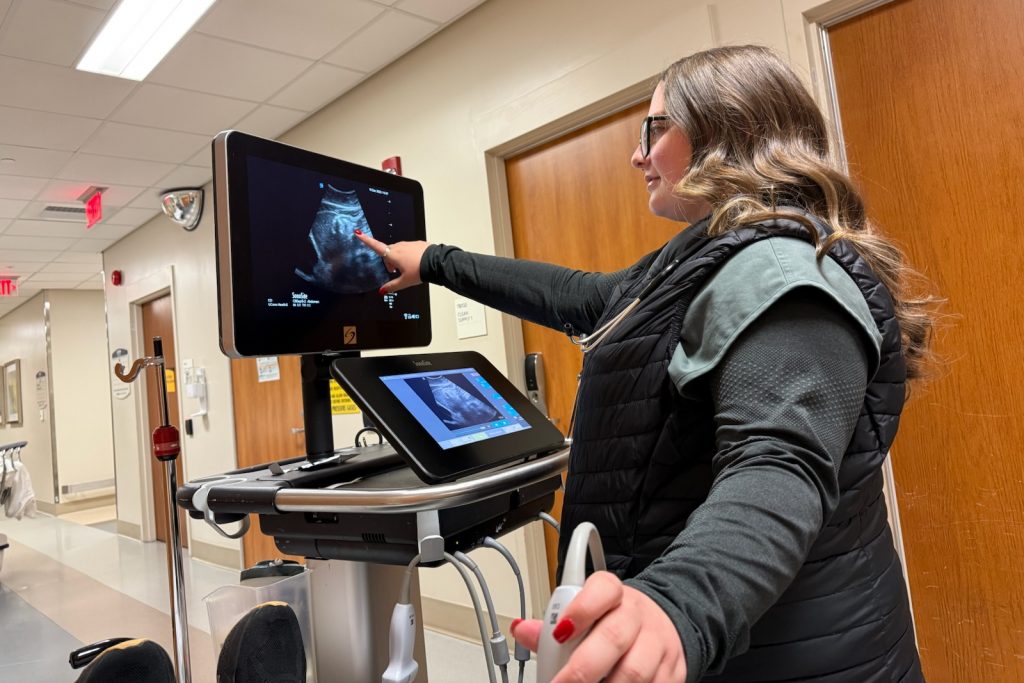 UConn medical student Niki Meka performing an abdominal ultrasound in the ED to check for gastric distention 