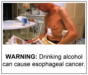 A man with a feeding tube coming from his abdomen reads a newspaper in a medical setting with a text warning written below about the esophageal cancer risk of drinking alcohol.