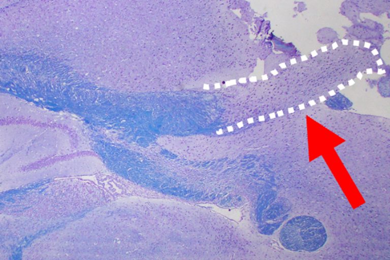 A microscopic view of a brain with a portion outlined in white with a red arrow pointing to the outline