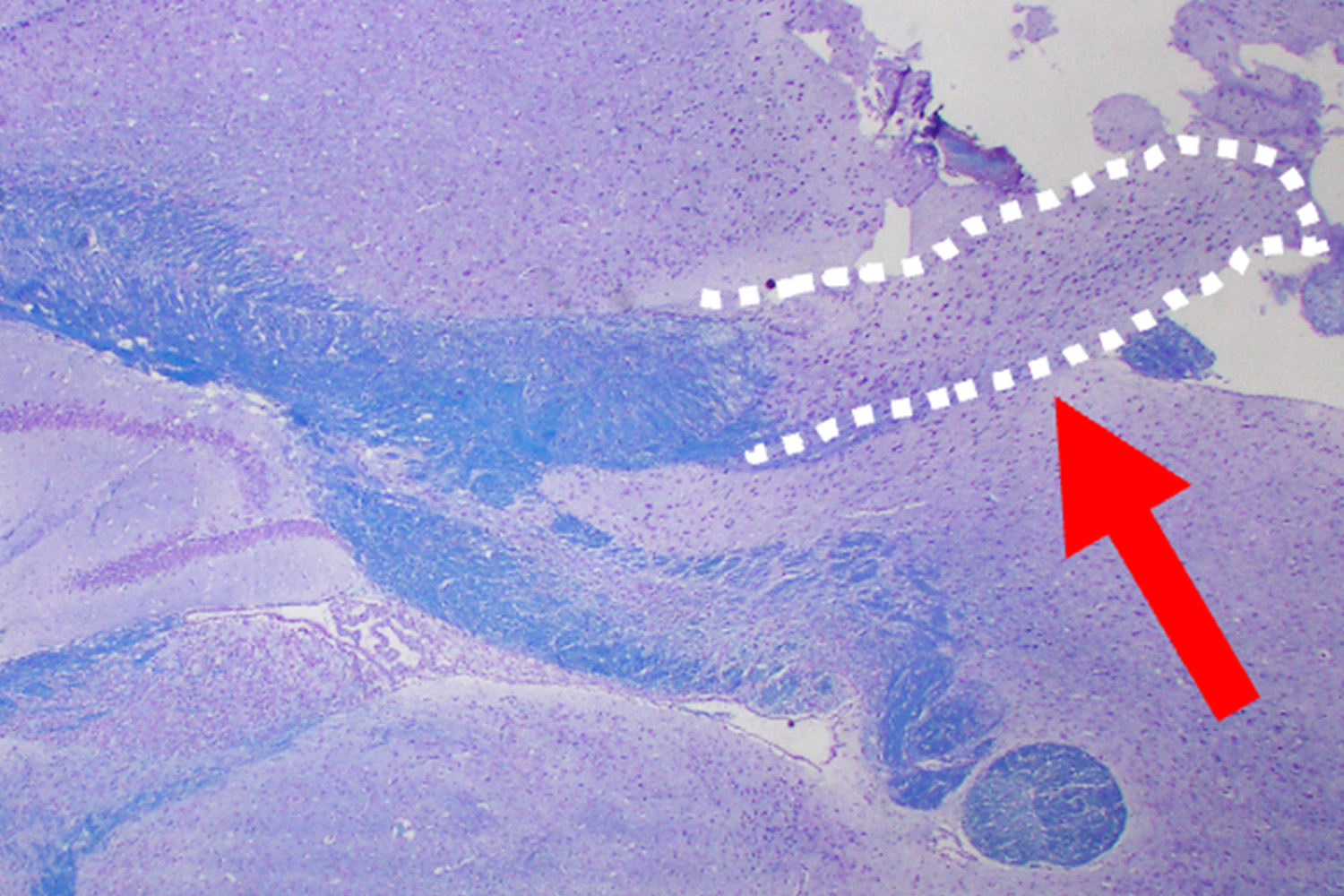 A microscopic view of a brain with a portion outlined in white with a red arrow pointing to the outline