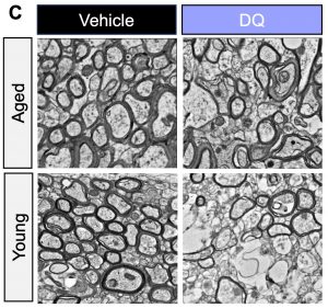 Four squares of brain tissue as seen from a microscope with the words "vehicle" and "dq" along the x axis and "aged" and "young" along the y axis