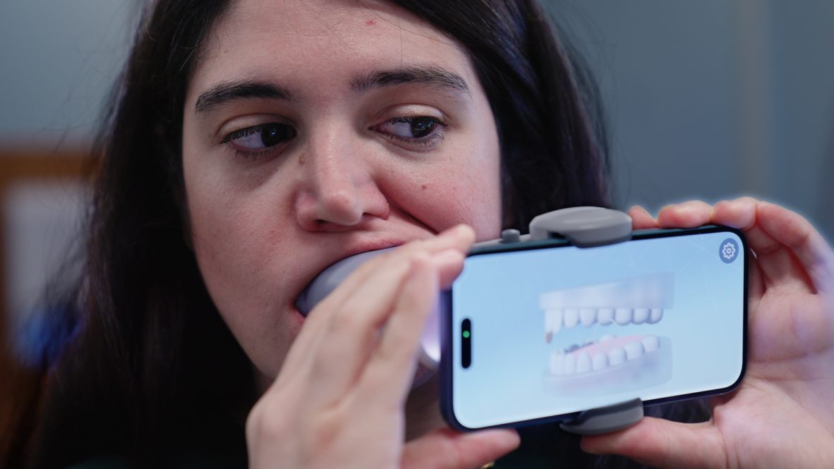 A mock patient demonstrates using a scan box and her cell phone how AI is being used in orthodontics. (Ryan Bernat/UConn Health)