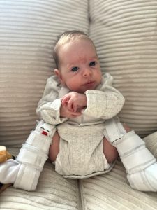 baby sitting with braces on her legs