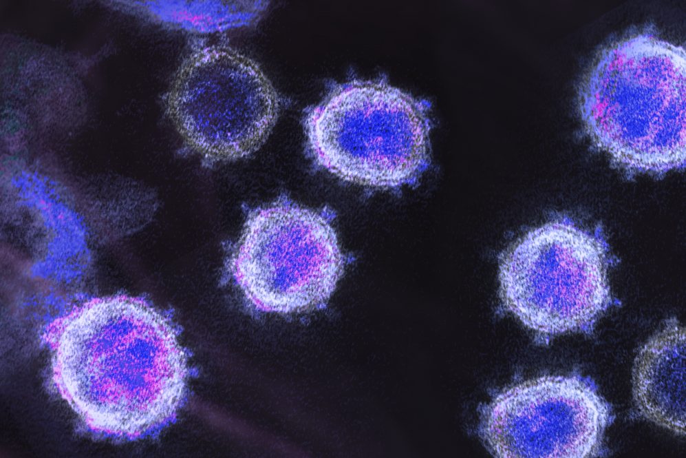 Microscopic image showing cellular structures against a dark background.