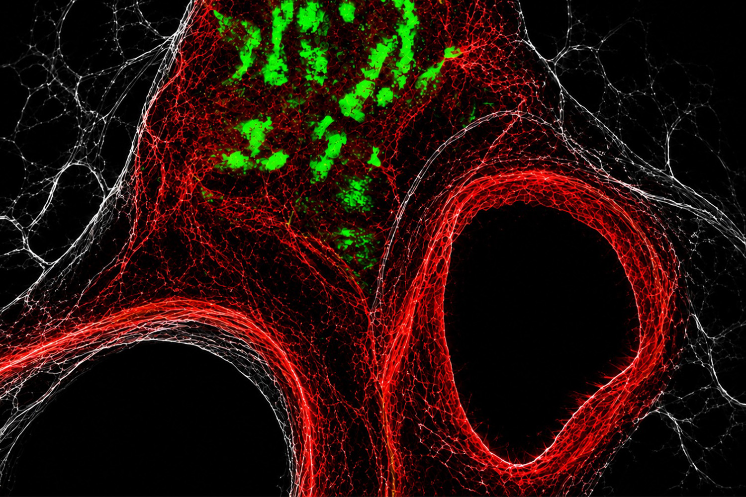 A cross section of the carotid body in a mouse. The oxygen sensing cells (green) sit adjacent to the carotid artery, right where it splits before entering the brain.