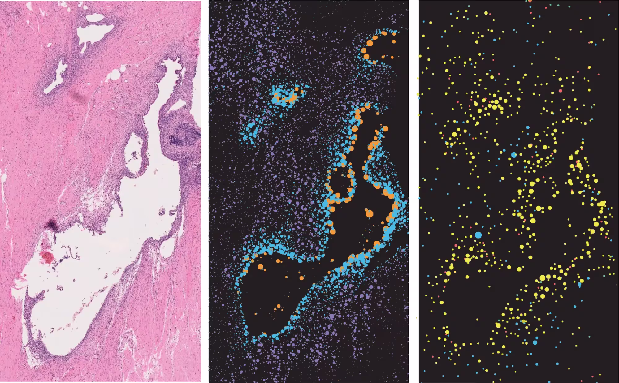 human lesions